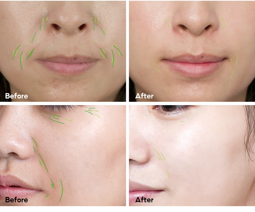 Hexapeptide Collagen Serum 15ml Anti-Aging Firming Hydration 8 hexapeptide collagen serum 15ml vib h8rmss98 desc 8