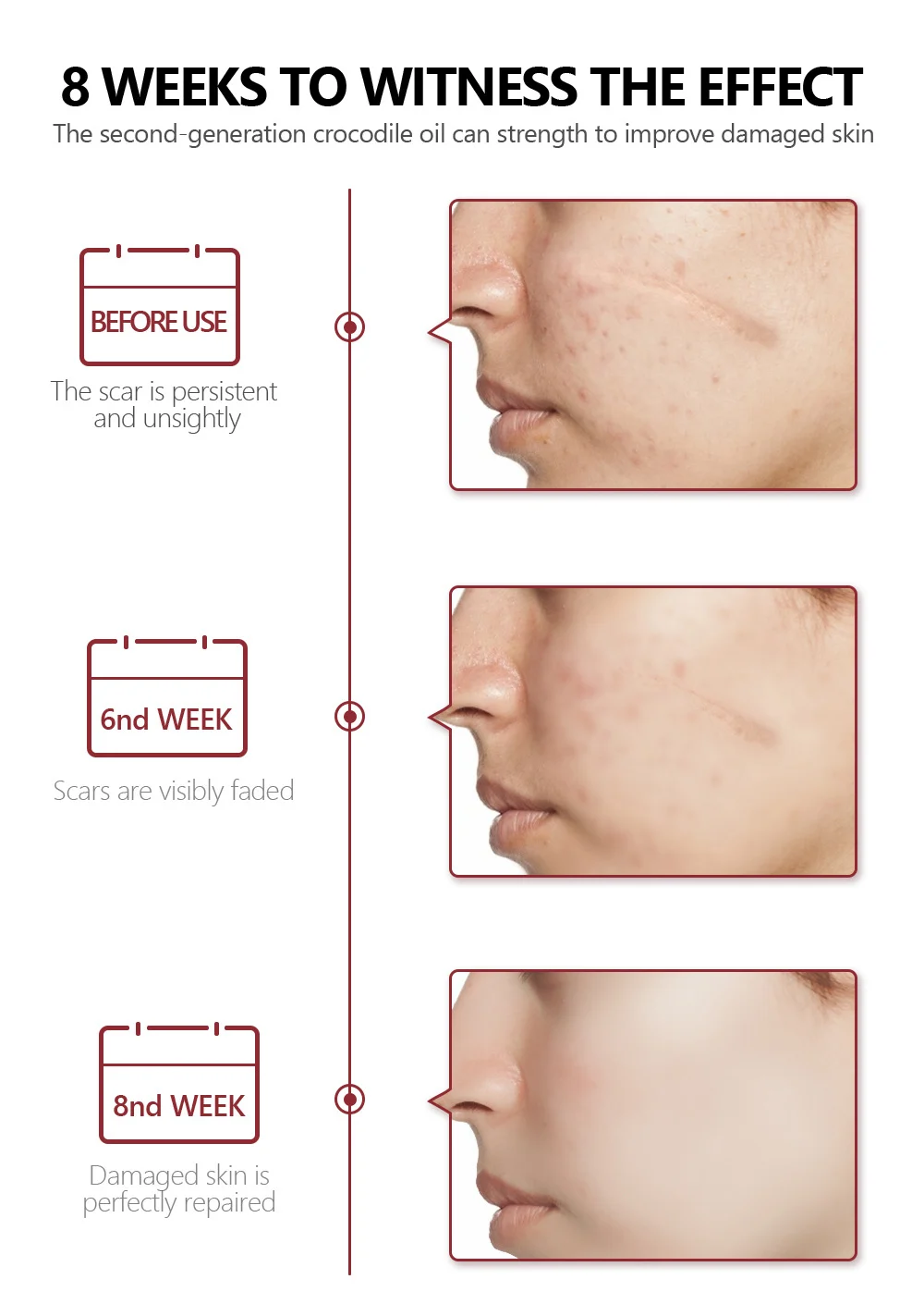 Crocodile Scar Removal Serum by VIBRANT GLAMOUR - 2nd Gen Acne Pit Repair & Pigment Reducer (30ml) 11 vibrant glamour crocodile scar removal serum 30ml vib ffyfaeuv desc 11