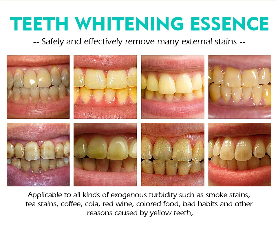 Teeth Whitening Pen Herbal Mint Formula for Stain Removal & Brightening 3 vibrant glamour herbal mint teeth whitening pen vib ag58a3ex desc 3