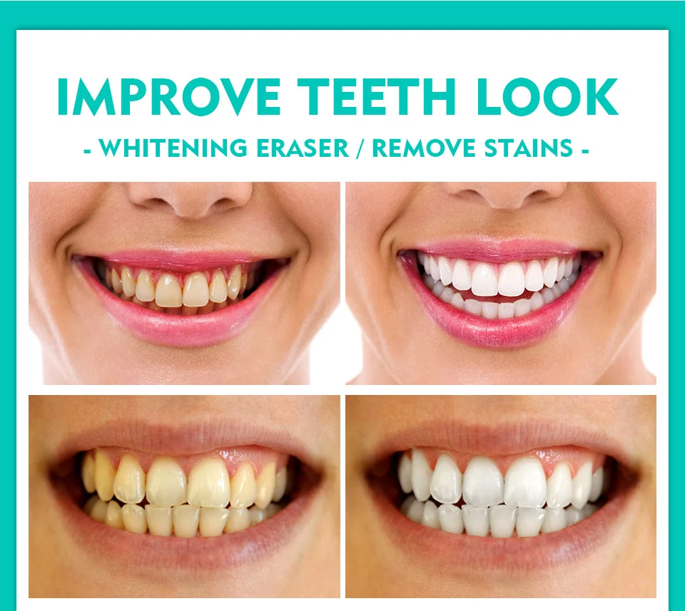 Teeth Whitening Pen Herbal Mint Formula for Stain Removal & Brightening 4 vibrant glamour herbal mint teeth whitening pen vib ag58a3ex desc 4